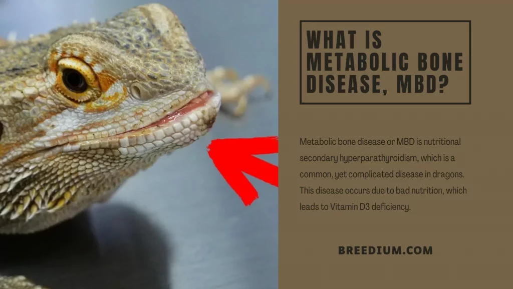 What Is Metabolic Bone Disease